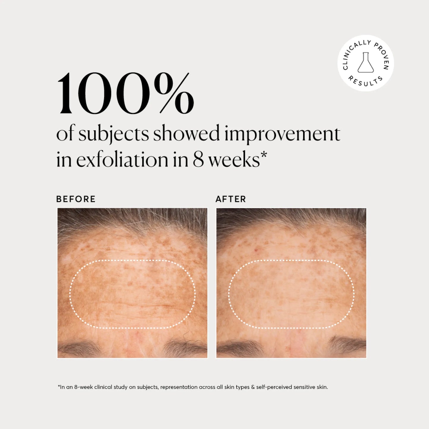 bha-liquid-exfoliant-2-l5 NATR-10027-Alt-Images-BHA-Liquid-Exfoliant-2_-03.webp