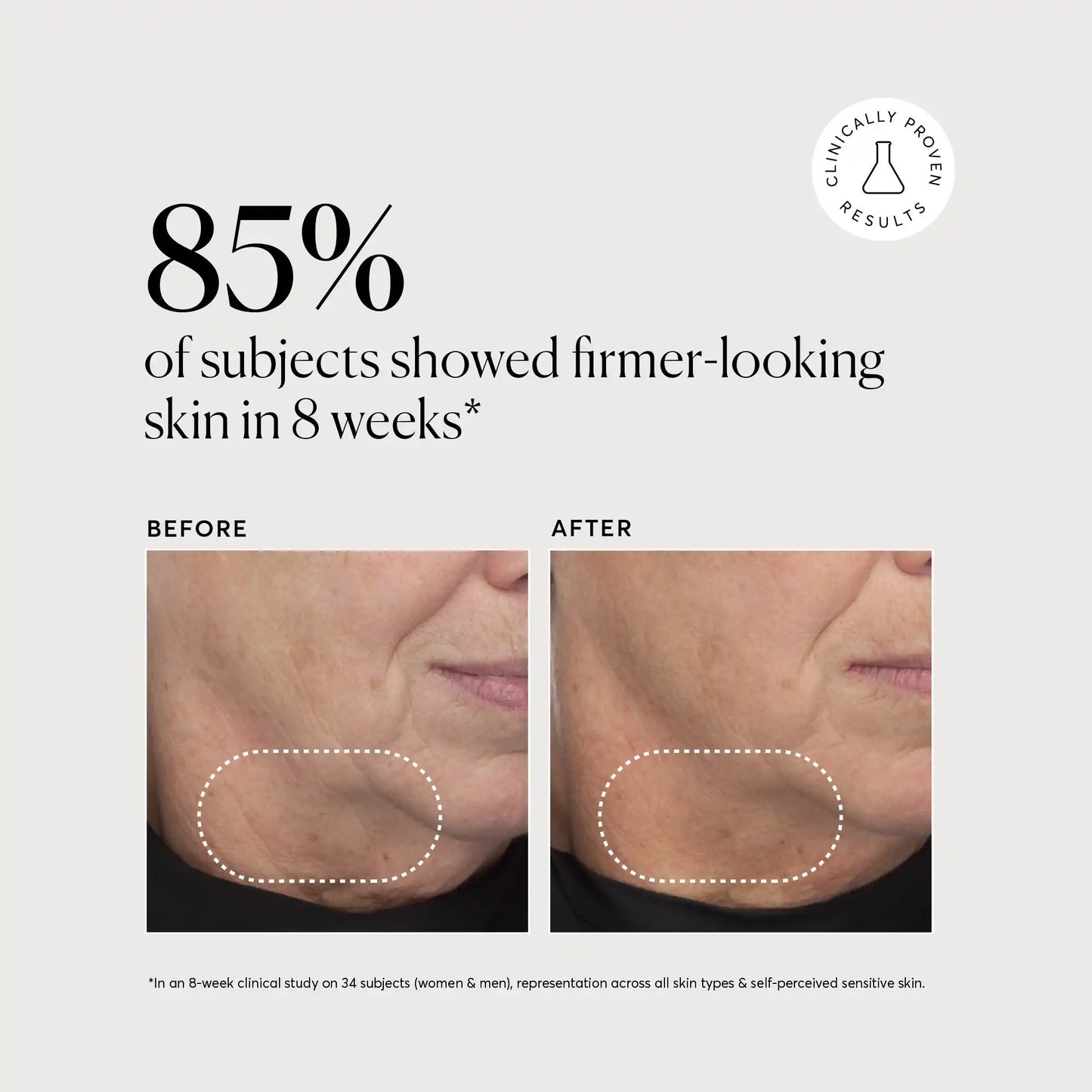 retinol-complex-serum-f1 NATR-10034-Alt-Images-Retinol-Complex-Serum-04.webp
