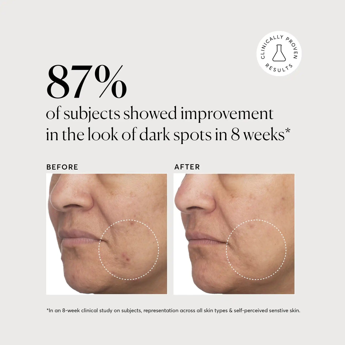 tranexamic-topical-acid-5-w7 NATR_Tranexamic_Acid_Clinical_Brighter_B_A_Bone.webp